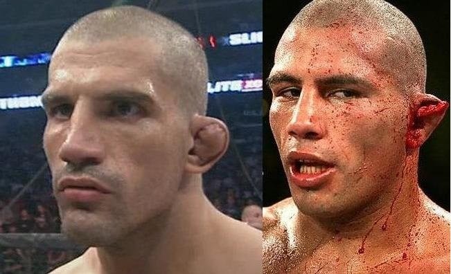 What Causes Dustin Poiriers Ears to Look Different? The Truth Behind Cauliflower Ear