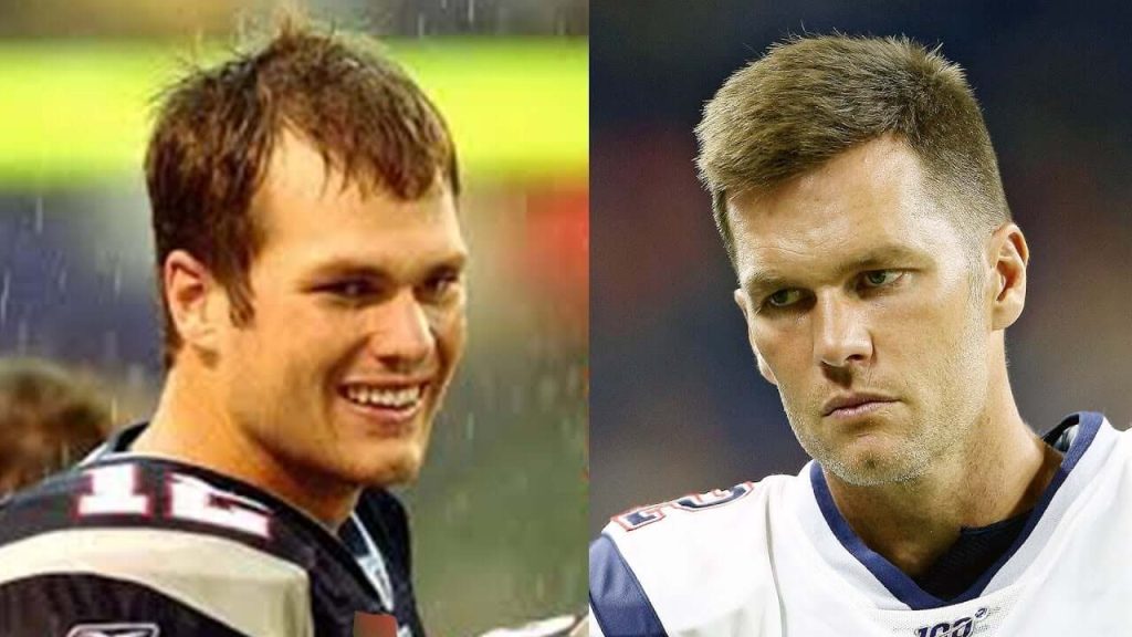 Exploring Tom Bradys Hair Plugs: The Real Story Behind His Transformation