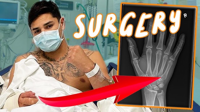 Ryan Garcia Hand Tattoo: Why Did He Get It? Get the Full Scoop!