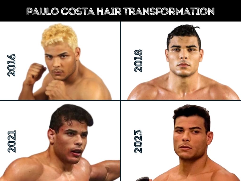 Is Paulo Costa Really Balding? The Truth Behind the Rumors