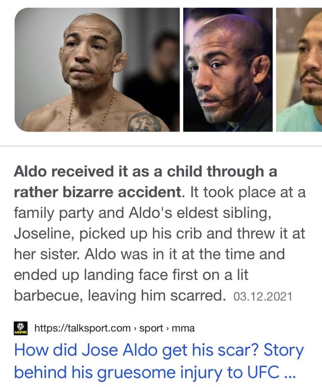 Jose Aldos face scar: How did he get it? Heres the real story explained for you.