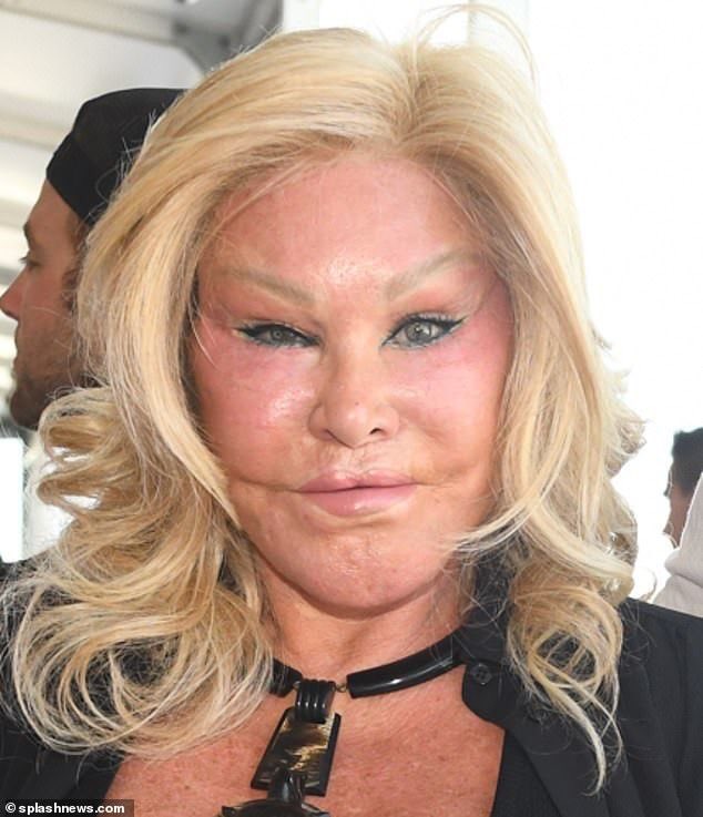 Plastic Surgery Secrets: Truth About Taylor Fritzs Moms Transformation?