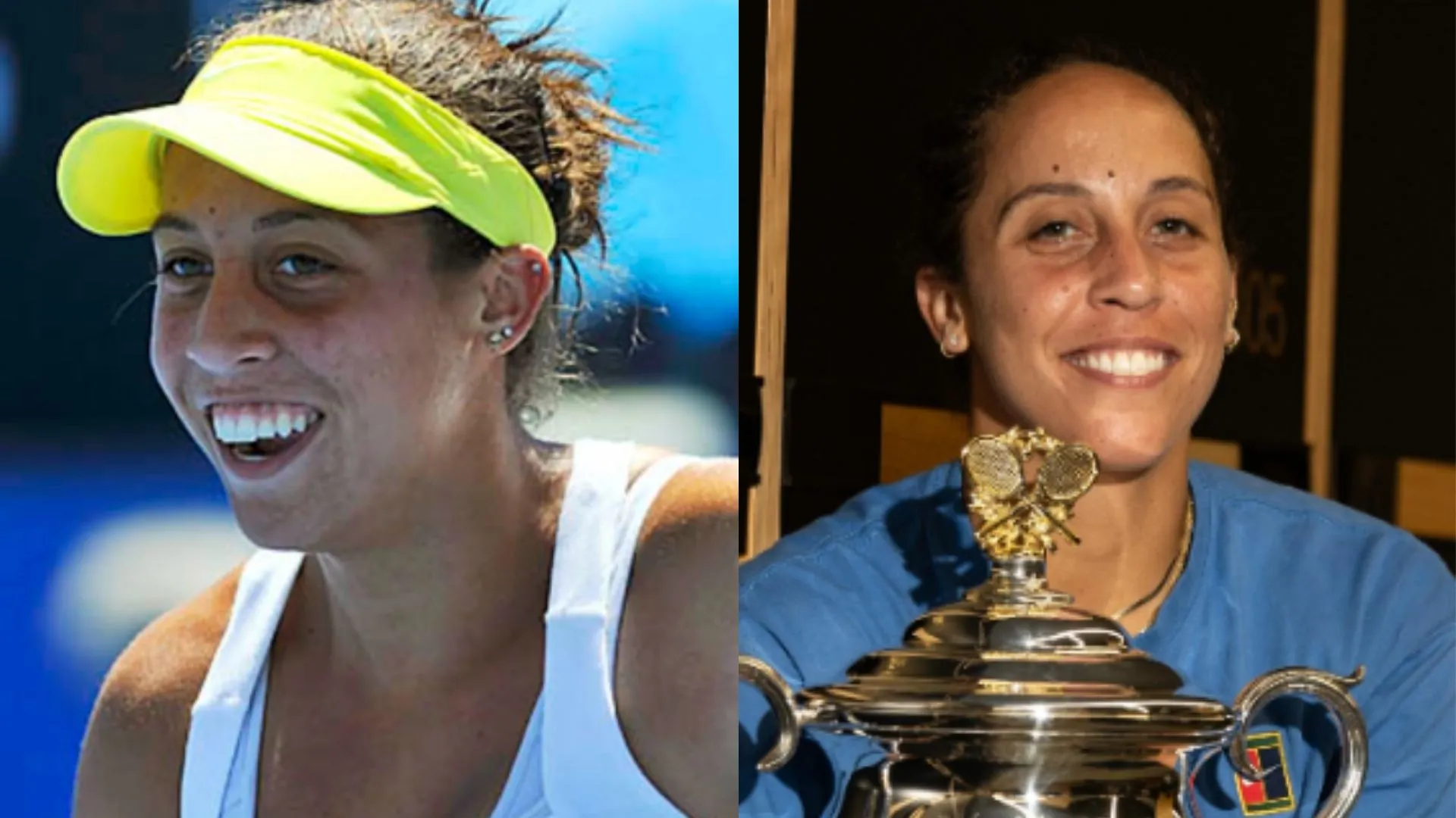 Madison Keys Smile: Addressing the Buck Teeth Talk (Pictures)