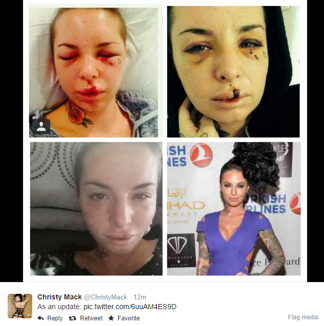 Look at Christy Mack Before and After: Her Crazy Change